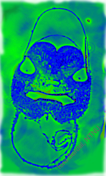 turbot man
