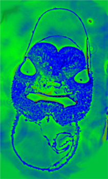 turbot man